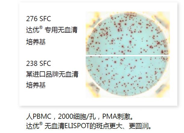 人淋巴細(xì)胞無血清培養(yǎng)基-斑點2.jpg